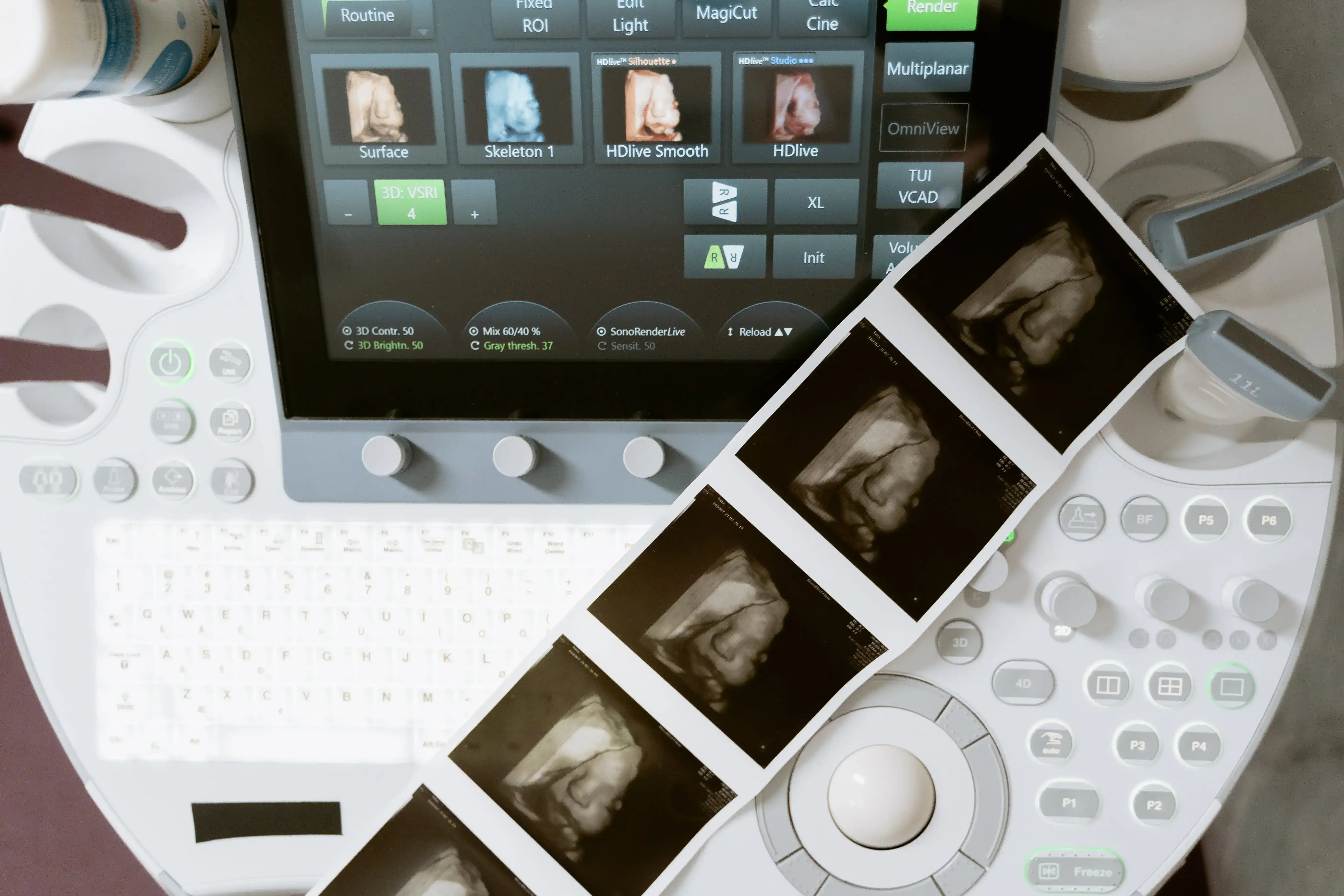 Pregnency